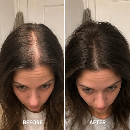 Deoxyribose Scalp Serum