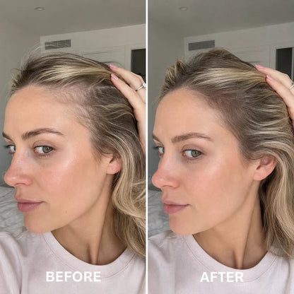 Deoxyribose Scalp Serum