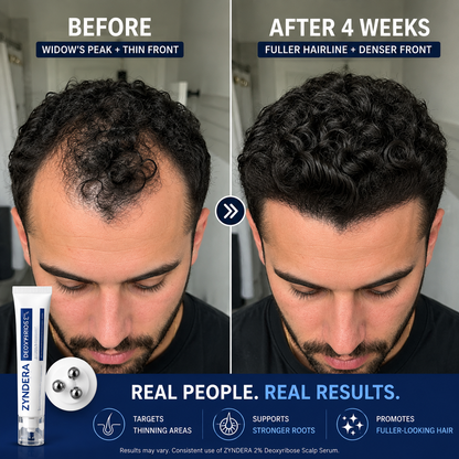 Deoxyribose Scalp Serum