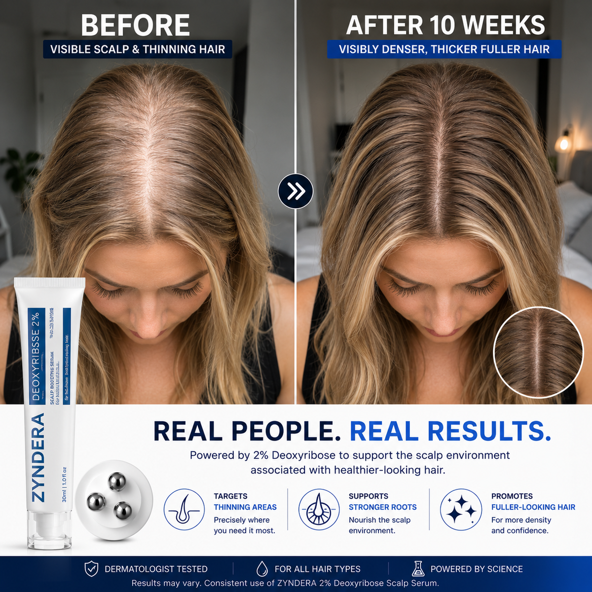 Deoxyribose Scalp Serum